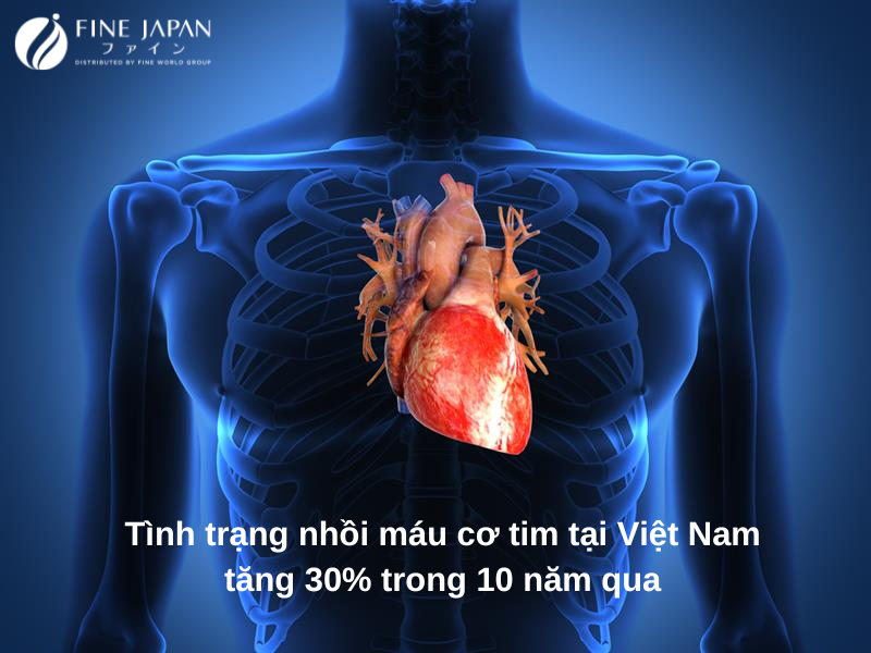 Tình trạng nhồi máu cơ tim tại Việt Nam tăng 30%