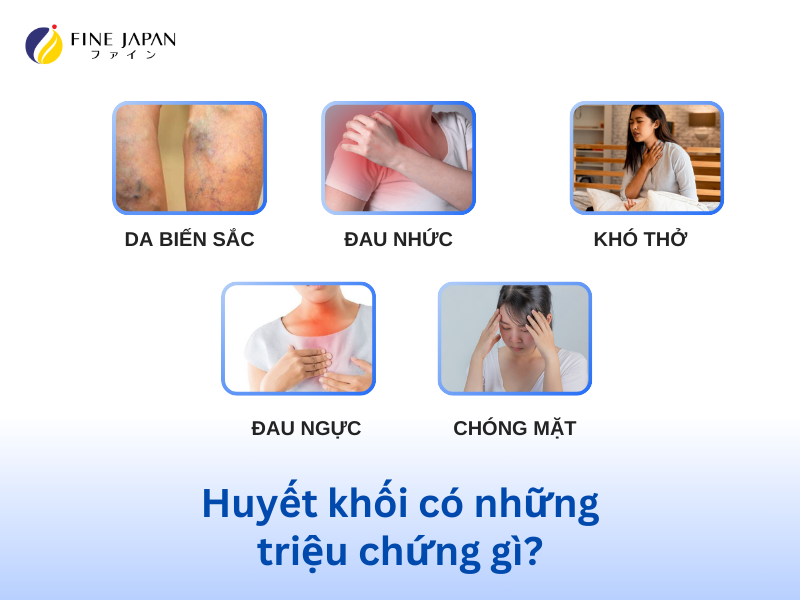 Vùng da quanh huyết khối có thể trở nên đỏ hoặc tím, đặc biệt là ở chân.