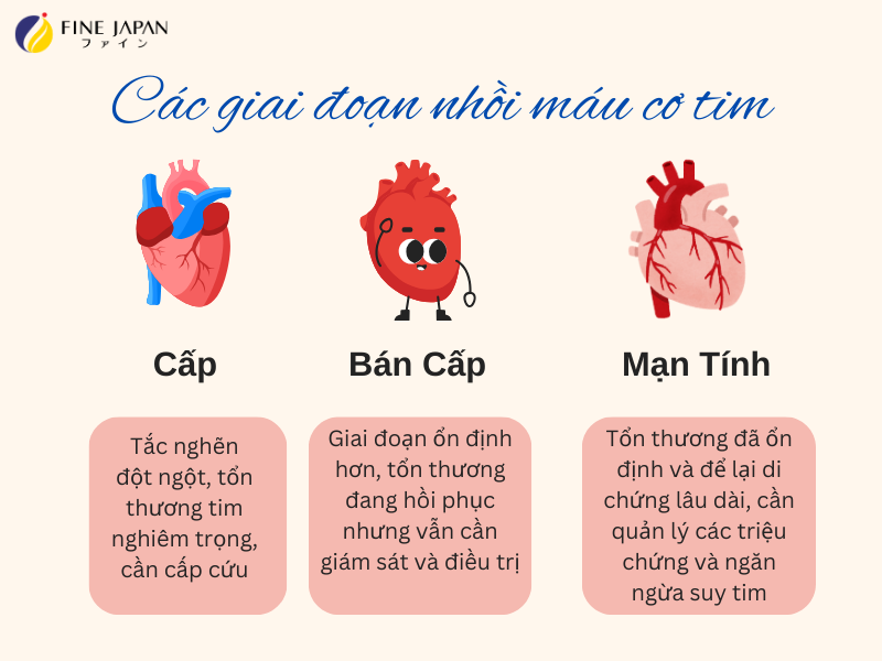 Sự khác biệt giữa nhồi máu cơ tim và nhồi máu cơ tim cấp